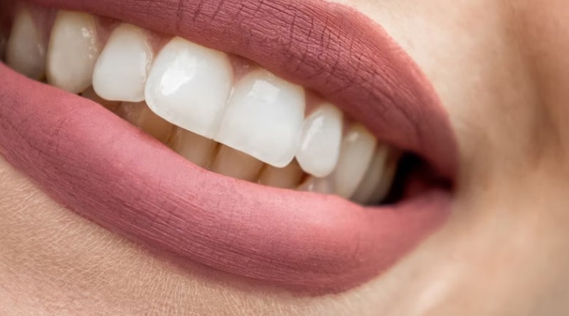 Sonrisa